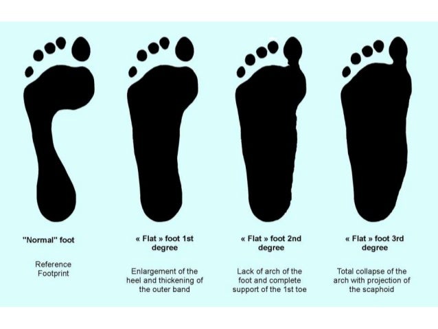 mature feet in slings The amatures movie